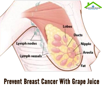 Prevent Breast Cancer With Grape Juice