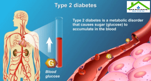 Step By Step Plan To Take Control Of Type 2 Diabetes