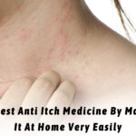 Try Best Anti Itch Medicine By Making It At Home Very Easily