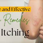 Simple and Effective Home Remedies for Itching