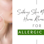 Soothing Skin Naturally_ Home Remedies for Allergic Skin