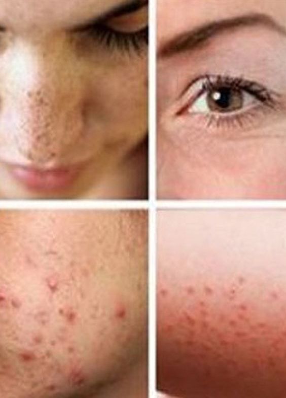 Types Of Skin Allergy Pictures