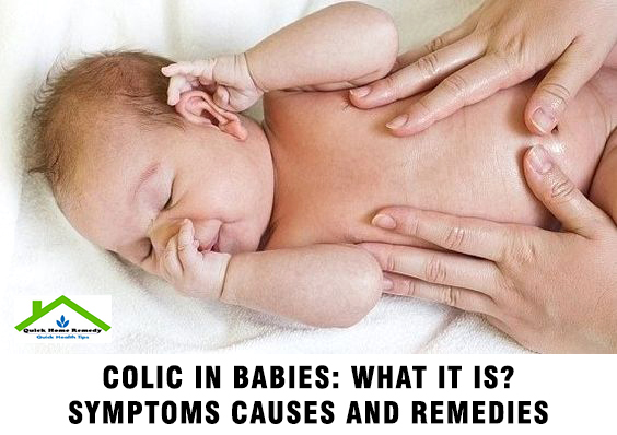 Colic In Babies: What It Is? Symptoms Causes And Remedies