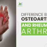 Difference Between Osteoarthritis And Rheumatoid Arthritis