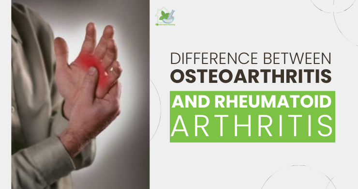 Difference Between Osteoarthritis And Rheumatoid Arthritis