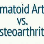 Difference Between Osteoarthritis And Rheumatoid Arthritis | Arthritis Home Remedies