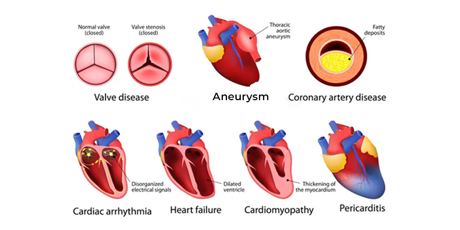 Heart diseases, then