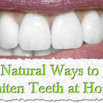 Top 10 Ways To Whiten Your Teeth At Home