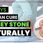 Cure Kidney Stone Naturally