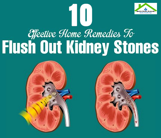 10 Ways You Can Cure Kidney Stone Naturally