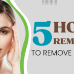 5 Home Remedies to Remove Sun Tan