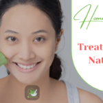 Treat Pimples Naturally