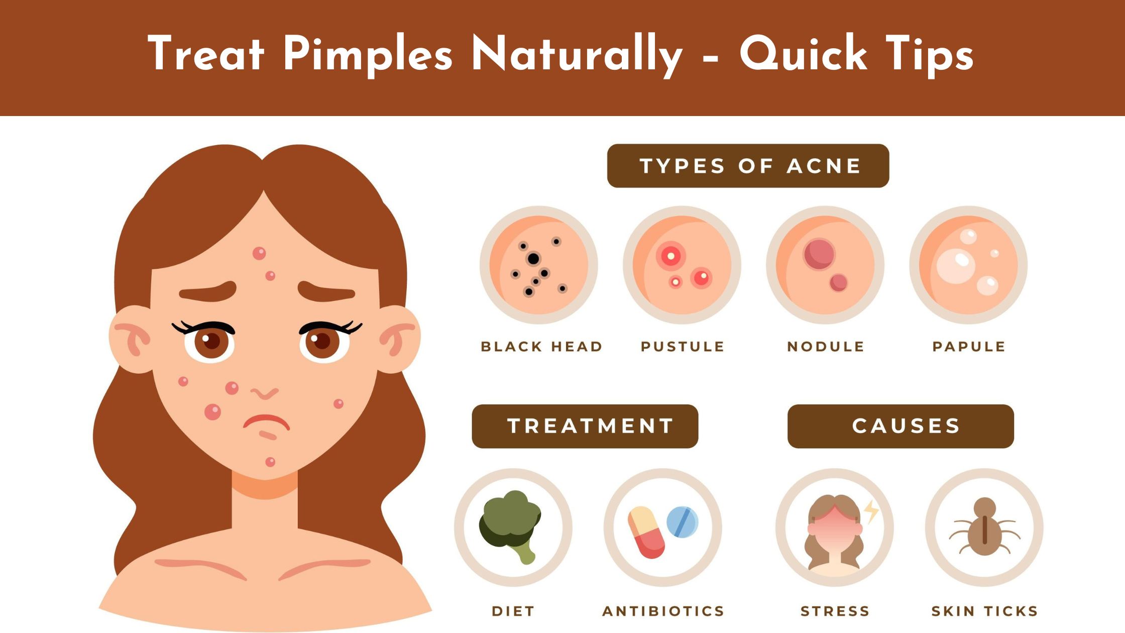 Home Remedies To Treat Pimples Naturally – Quick Tips
