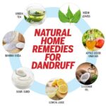 dandruff home remedy