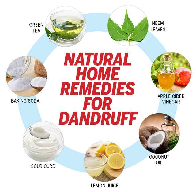 dandruff home remedy