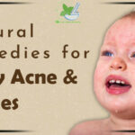 Baby Acne & Rashes