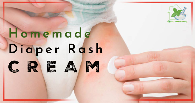 How To Prepare Homemade Diaper Rash Cream For Yeast Infection