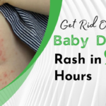 Get Rid Of A Baby Diaper Rash In 24 Hours