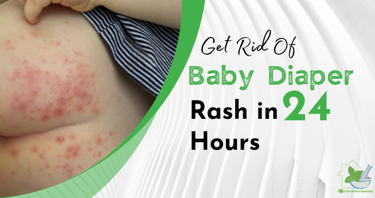 Get Rid Of A Baby Diaper Rash In 24 Hours