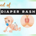 Get Rid of Diaper Rash