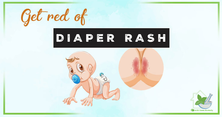 Get Rid of Diaper Rash