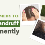 Home Remedy To Cure Dandruff Permanently (1)