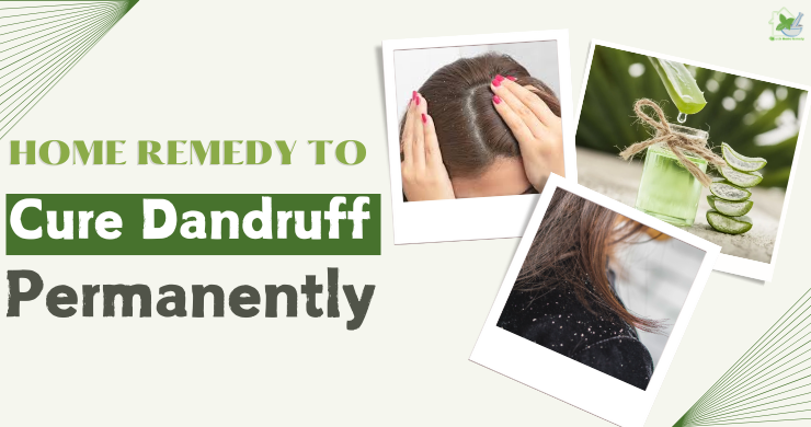 Home Remedy To Cure Dandruff Permanently (1)